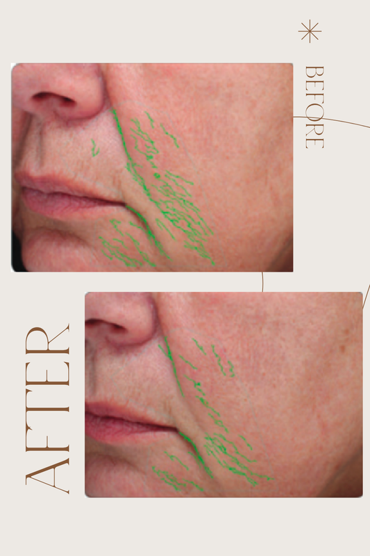 BioPeptide Growth Factor (1.8 oz | 51g)